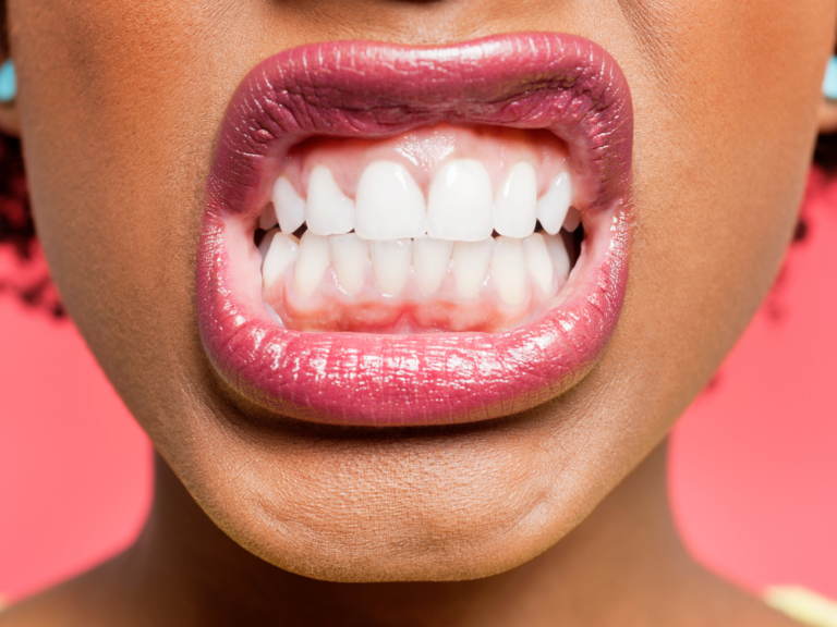5 råd til god mundhygiejne – sunde tænder HELE livet